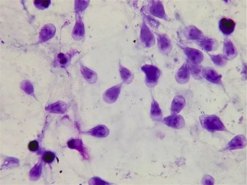 wie man menschliche Lamblia loswird